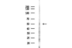 anti-Monocarboxylate Transporter 3 (MCT3) (C-Term) antibody