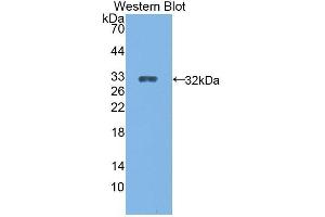 Western Blotting (WB) image for anti-Cytochrome P450, Family 27, Subfamily B, Polypeptide 1 (CYP27B1) (AA 251-500) antibody (ABIN1862408)