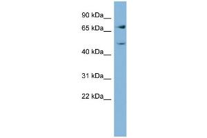 WB Suggested Anti-GFPT2  Antibody Titration: 0. (GFPT2 antibody  (Middle Region))