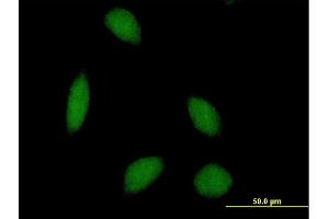 Immunofluorescence of purified MaxPab antibody to ALS2CR8 on HeLa cell. (Calcium Responsive Transcription Factor (CARF) (AA 1-718) antibody)