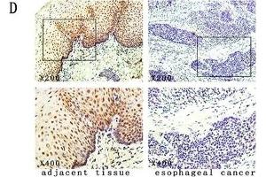 The expression and methylation status of IGFBPL1 in human esophageal dysplasia and ESCC. (IGFBPL1 antibody  (AA 201-278))