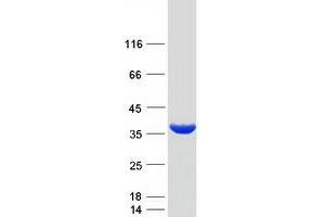 Validation with Western Blot