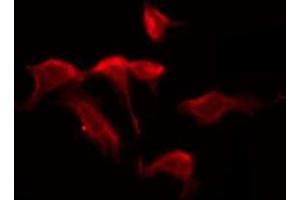 ABIN6276050 staining HuvEc by IF/ICC. (PAQR5 antibody  (C-Term))