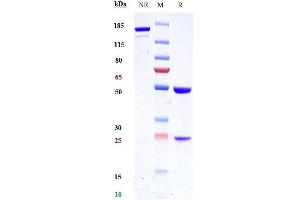 Anti-KLK2 / Kallikrein 2 Reference Antibody (JNJ-69086420) on SDS-PAGE under reducing (R) condition.