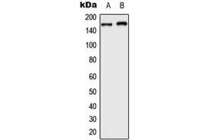 Western blot analysis of BAF250B expression in HeLa (A), HepG2 (B) whole cell lysates. (ARID1B antibody  (Center))