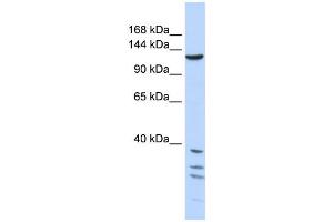 Western Blotting (WB) image for anti-Tankyrase, TRF1-Interacting Ankyrin-Related ADP-Ribose Polymerase (TNKS) antibody (ABIN2458045) (TNKS antibody)