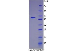 SDS-PAGE of Protein Standard from the Kit (Highly purified E. (Transferrin ELISA Kit)
