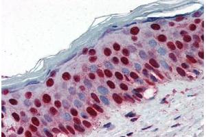 Human Skin (formalin-fixed, paraffin-embedded) stained with NPM1 antibody ABIN364324 at 5 ug/ml followed by biotinylated anti-mouse IgG secondary antibody ABIN481714, alkaline phosphatase-streptavidin and chromogen. (NPM1 antibody  (AA 81-294))