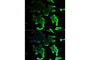 Immunofluorescence analysis of HeLa cells using TANK antibody (ABIN5974093). (TANK antibody)