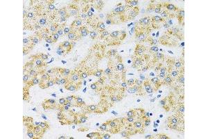 SLC16A4 antibody
