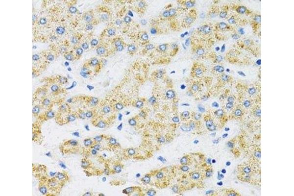 SLC16A4 antibody