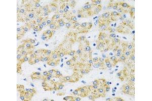 Immunohistochemistry of paraffin-embedded Human liver using SLC16A4 Polyclonal Antibody at dilution of 1:100 (40x lens). (SLC16A4 antibody)