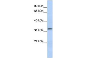 WB Suggested Anti-LACTB2 Antibody Titration: 0. (LACTB2 antibody  (Middle Region))