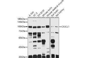 Western blot analysis of extracts of various cell lines, using CX3CL1 antibody (ABIN6129035, ABIN6139265, ABIN6139266 and ABIN6218481) at 1:1000 dilution. (CX3CL1 antibody  (AA 365-397))