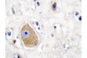 Immunohistochemistry analyzes of HADH2 antibody in paraffin-embedded human brain tissue. (HSD17B10 antibody)