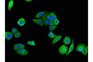 Immunofluorescent analysis of HepG2 cells using ABIN7162439 at dilution of 1:100 and Alexa Fluor 488-congugated AffiniPure Goat Anti-Rabbit IgG(H+L) (P2RX1 antibody  (AA 54-175))