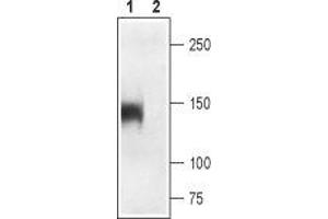 Western blot analysis of rat skeletal muscle: - 1. (CACNA1S antibody  (2nd Extracellular Loop, Domain 4))