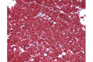 Anti-SLC2A1 / GLUT1 antibody IHC of human colon, erythrocytes.