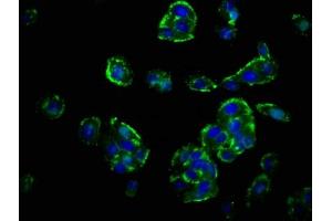 Immunofluorescence staining of HepG2 cells with ABIN7154525 at 1:67, counter-stained with DAPI. (GHRHR antibody  (AA 23-127))