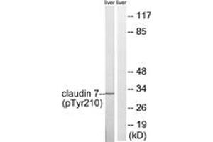 Western blot analysis of extracts from rat liver, using Claudin 7 (Phospho-Tyr210) Antibody. (Claudin 7 antibody  (pTyr210))