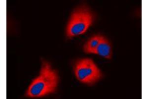 Immunofluorescent analysis of S6K1 (pT444) staining in HepG2 cells. (RPS6KB1 antibody  (C-Term, pSer444))