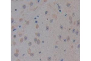 #VALUE! (CELSR3 antibody  (AA 942-1175))