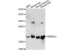 Western blot analysis of extracts of various cell lines, using ORMDL3 antibody. (ORMDL3 antibody)