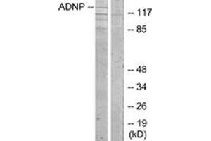 Western Blotting (WB) image for anti-Activity-Dependent Neuroprotector Homeobox (ADNP) (AA 111-160) antibody (ABIN2889758) (ADNP antibody  (AA 111-160))