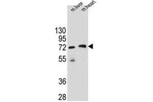 Western blot analysis of KCTD8 Antibody (C-term) in mouse liver and heart tissue lysates (35ug/lane). (KCTD8 antibody  (C-Term))