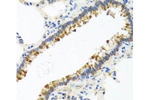 Immunohistochemistry of paraffin-embedded Rat lung using CST4 Polyclonal Antibody at dilution of 1:100 (40x lens). (CST4 antibody)