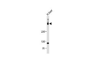 Anti-SYNE2 Antibody (N-Term) at 1:1000 dilution + Human liver lysate Lysates/proteins at 20 μg per lane. (SYNE2 antibody  (AA 1843-1877))