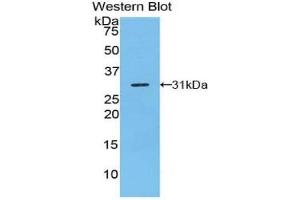 Western blot analysis of the recombinant protein. (TRADD antibody  (AA 24-261))