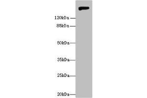 Western blot All lanes: Nid1 antibody at 6 μg/mL + Rat lung tissue Secondary Goat polyclonal to rabbit IgG at 1/10000 dilution Predicted band size: 137 kDa Observed band size: 150 kDa (Nidogen 1 antibody  (AA 428-665))