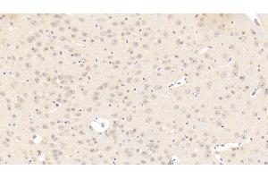 Detection of CACNa1C in Mouse Cerebrum Tissue using Polyclonal Antibody to Calcium Channel, Voltage Dependent, L-Type, Alpha 1C Subunit (CACNa1C) (CACNA1C antibody  (AA 1978-2139))