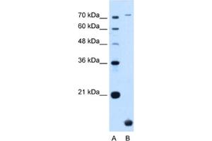 Western Blotting (WB) image for anti-Transmembrane Protein 91 (TMEM91) antibody (ABIN2463996) (TMEM91 antibody)