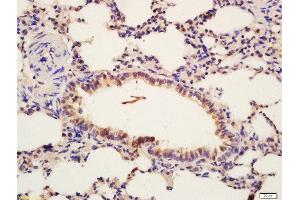 Formalin-fixed and paraffin embedded mouse lung labeled with Rabbit Anti-Insulin Receptor Beta (Tyr1185) Polyclonal Antibody, Unconjugated  at 1:200 followed by conjugation to the secondary antibody and DAB staining (ISR-beta antibody  (pTyr1185))