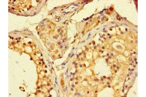 Immunohistochemistry of paraffin-embedded human testis tissue using ABIN7160851 at dilution of 1:100 (SIRT1 antibody  (AA 2-747))