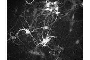 Immunochemical staining of cultured mouse caudate neurons with Ppp1r1b polyclonal antibody . (DARPP32 antibody  (N-Term))