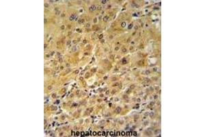 Immunohistochemistry (IHC) image for anti-FK506 Binding Protein 1A, 12kDa (FKBP1A) antibody (ABIN3003472) (FKBP1A antibody)