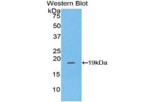 Western Blotting (WB) image for anti-Pleckstrin Homology-Like Domain, Family A, Member 2 (PHLDA2) (AA 9-140) antibody (ABIN1860206) (PHLDA2 antibody  (AA 9-140))