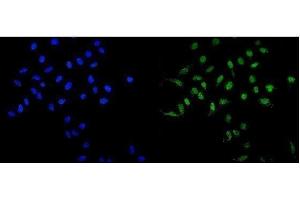 anti-MAD1 Mitotic Arrest Deficient-Like 1 (MAD1L1) (AA 362-632) antibody