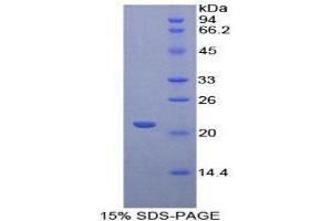 SDS-PAGE (SDS) image for CD8b Molecule (CD8B) (AA 22-175) protein (His tag) (ABIN2124398)