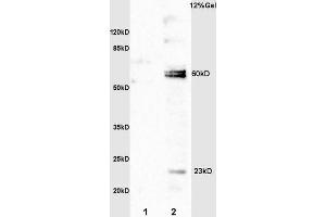 SDS-PAGE (SDS) image for anti-Interleukin 20 Receptor alpha (IL20RA) (AA 135-171) antibody (ABIN748103)