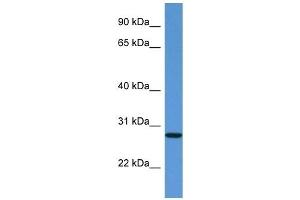 Western Blot showing EDN3 antibody used at a concentration of 1 ug/ml against Fetal Kidney Lysate (Endothelin 3 antibody  (C-Term))