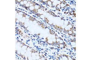Immunohistochemistry of paraffin-embedded human colon using GIP antibody (ABIN1882357) at dilution of 1:100 (40x lens). (GIP antibody)