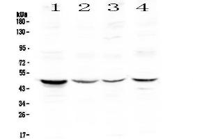 Western blot analysis of Caspase 4 using anti-Caspase 4 antibody . (Caspase 4 antibody  (AA 111-194))