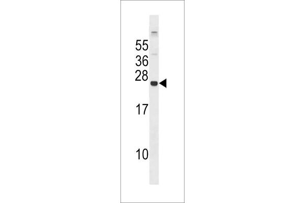 GPX8 antibody  (C-Term)