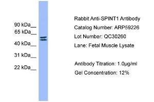 WB Suggested Anti-SPINT1  Antibody Titration: 0.