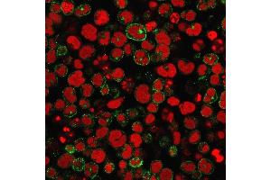 Immunofluorescence staining of MOLT-4 cells using CD2 Mouse Monoclonal Antibody (1E7E8.