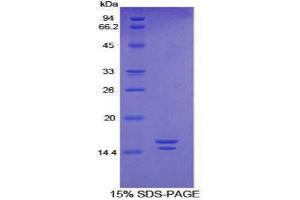 SDS-PAGE (SDS) image for Vasoactive Intestinal Peptide (Vip) (AA 29-165) protein (His tag) (ABIN1879967)